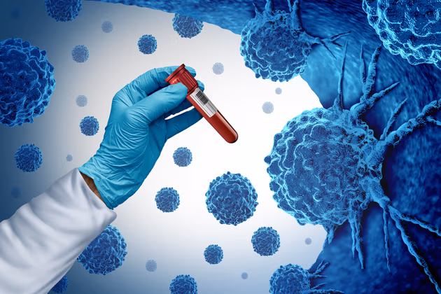 Cancer Treatment & Diagnosis