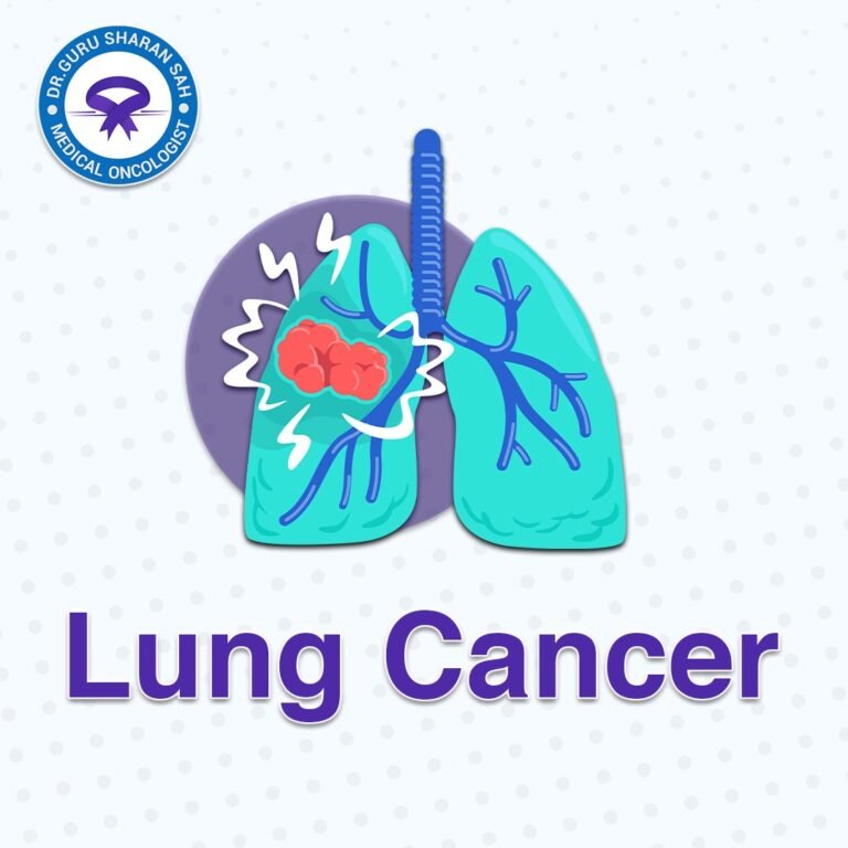 Lung Cancer
